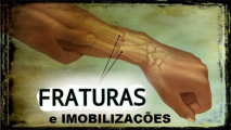 gallery/fraturas